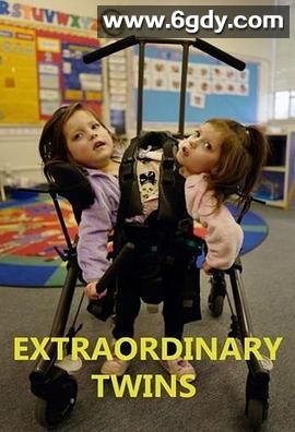 连体双胞胎(2020)完结2集全迅雷网盘全集下载